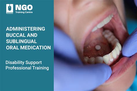 Administering Buccal and Sublingual Medication | NGO Training Centre