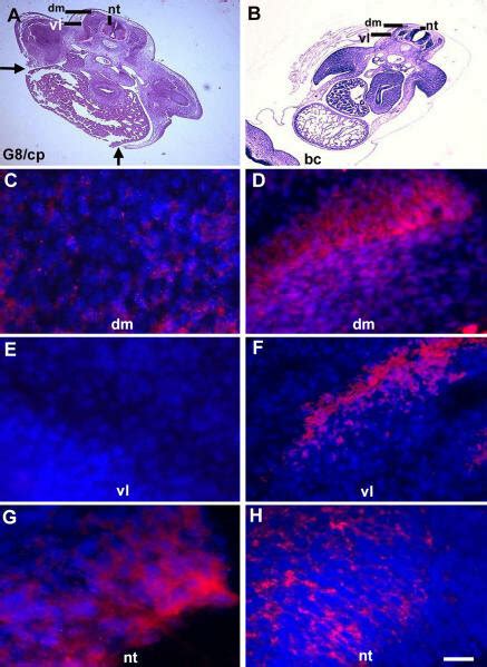 Effect Of Ablating G8pos Myodpos Epiblast Cells On Noggin Expression Download Scientific