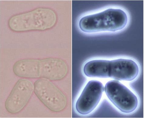 Schizosaccharomyces Fission Yeast Schizosaccharomyces Pombe Yeast