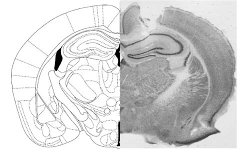 Photomicrograph Right And Schematic Drawing Left Based On Paxinos