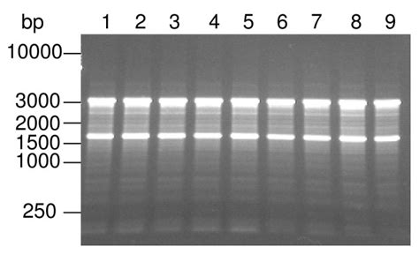 Representative image of electrophoresis of total RNA in agarose gel ...