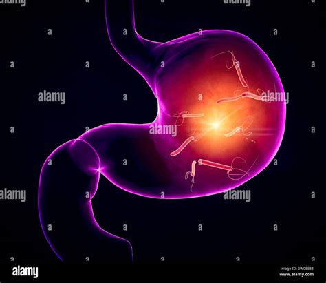 Mucosa Gastrica Immagini E Fotografie Stock Ad Alta Risoluzione Alamy