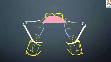 Labial Bow Functions Constructions Types And Indications Ppt