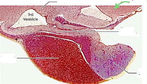 Ch 20 pituitary glad histology Flashcards | Quizlet