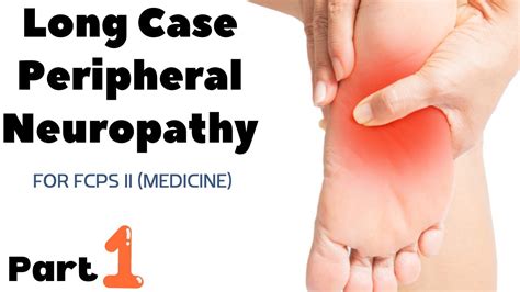 Long Case Peripheral Neuropathy Youtube