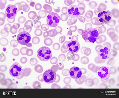 Neutrophil Cell (white Image & Photo (Free Trial) | Bigstock