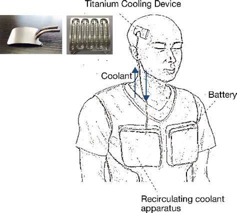 Figure From Optimal Design Of Neuroprotective Focal Brain Cooling