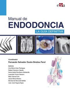 Manual de endodoncia La guía definitiva portofrei bei bücher de bestellen