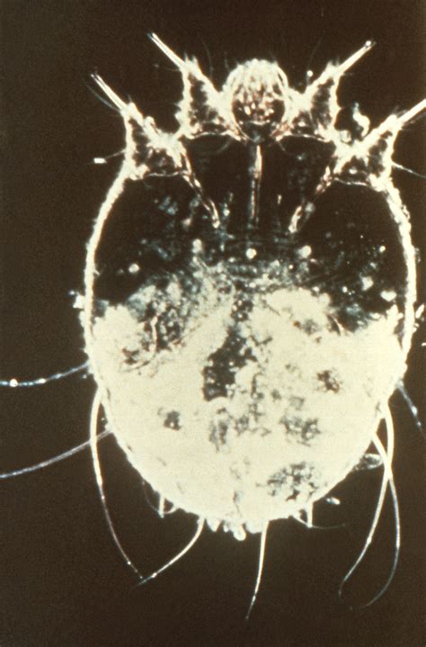 public domain picture    sarcoptes scabiei var hominis