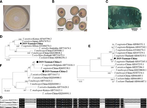 Frontiers Case Report Molecular Diagnosis Revealing An Intestinal