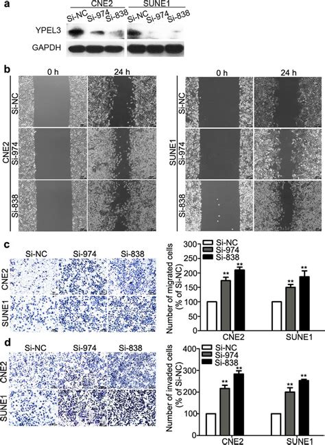 Effects Of Ypel Silencing On Npc Cell Migration And Invasion In Vitro