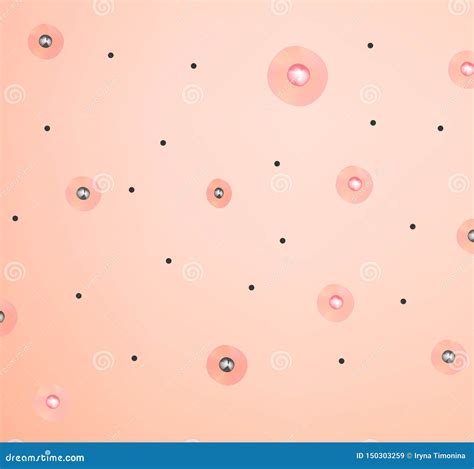 Inflamed Skin Tattoos