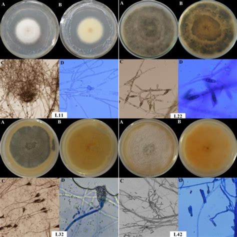 Morphology Of Endophytic Fungi Isolated From Syzygium Aqueum Leaves