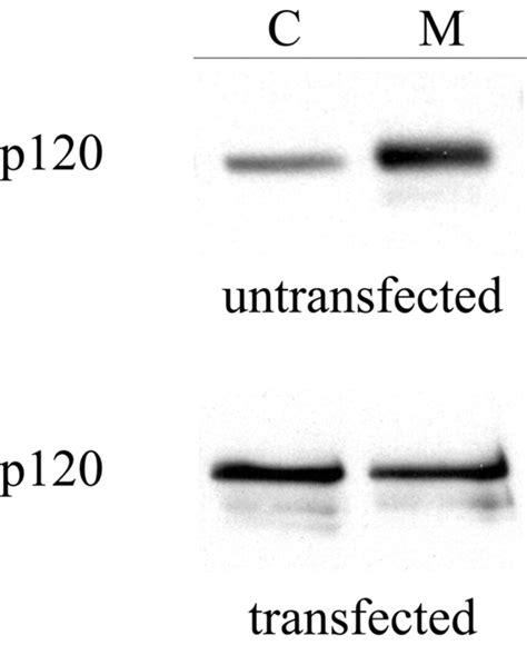 P120ctn Overexpression Increases The Cytosolic Pool Of P120ctn The