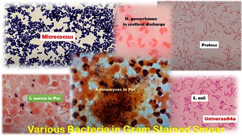 Enterobacter Aerogenes Gram Stain