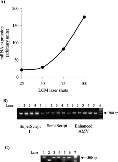 Comparison Of A Gapdh Gene Amplification By Rt Pcr Of Tissue Samples