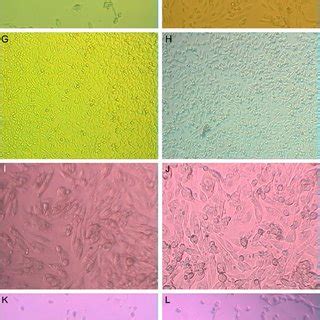 Effect Of Hypoxia And DMOG On Gene Expression In RCC10 And RCC4 Cells