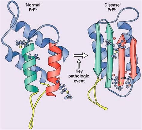 Prion Protein Disease And Neuropathology Of Prion Disease