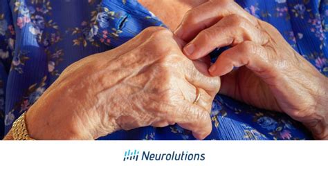 Apraxia Explained: Causes, Types, Symptoms, and Treatment Options ...