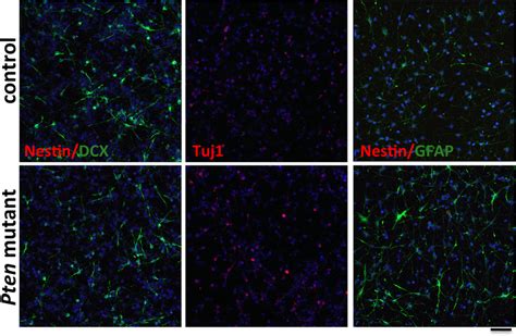 Pten Ablation Accelerates NSC Differentiation In Vitro Deletion Of