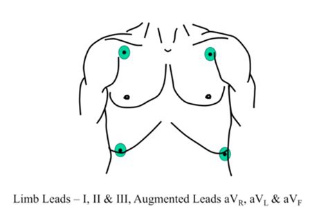 Cardiopulm 1 1 Basic Interpretation Of EKGs Flashcards Quizlet