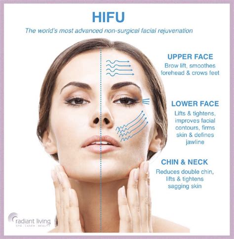 HIFU Face Lift - Radiant Living