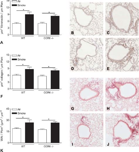 Figure 9 From Role Of Proteases And Chemokine Receptors In A Murine