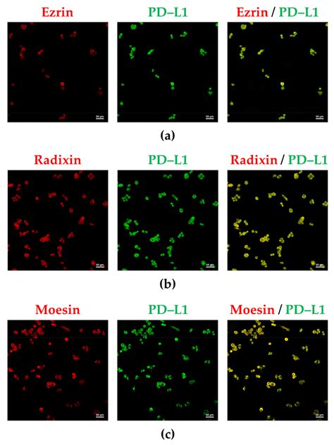 Jcm Free Full Text Ezrin Contributes To The Plasma Membrane