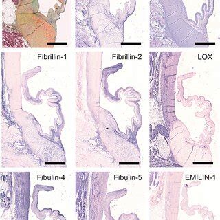 Valvular Interstitial Cell Vic Markers Tile Scans Of Sheep Aortic