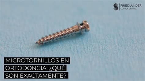 Microtornillos en ortodoncia Qué son exactamente YouTube