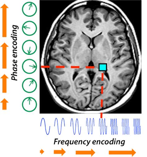 Signal Localization Questions And Answers In Mri