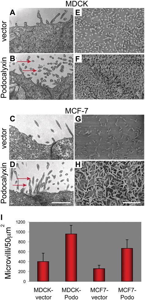 Podocalyxin Induces Microvillus Formation Mdck A B E F And Mcf