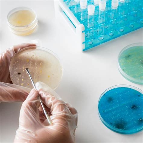 Fungal Culture Stool Test Lucid Diagnostics