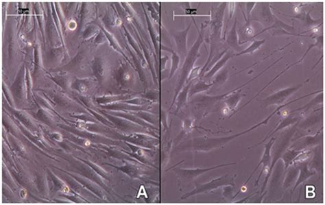 Novel In Vitro Platform To Investigate Myotube Atrophy Anticancer