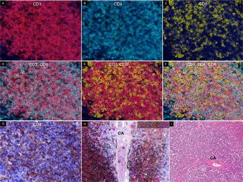 Staining Of Cd And Cd T Cells In Spleen Slides Were Stained With Cd