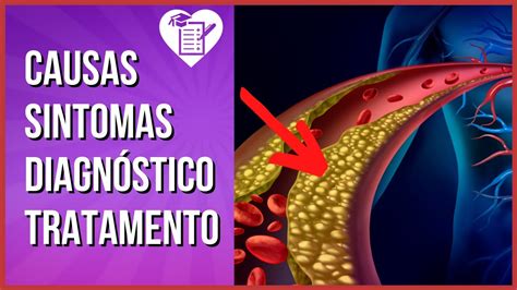 Dislipidemia Tipos Sintomas E Valores De Refer Ncia Youtube