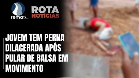 Jovem Tem Perna Dilacerada Ap S Pular De Balsa Em Movimento Youtube