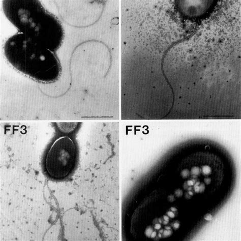 Electron Micrographs Of Negatively Stained Strain ML4 FF2 And FF3T