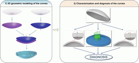 Diagnostic Approach of Corneal Topography Maps | Ento Key