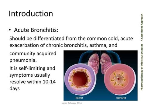 Acute bronchitis | PPT