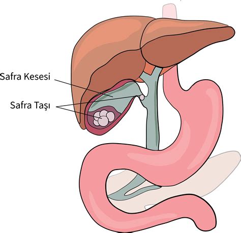 Safra Kesesi Ameliyatı Prof Dr Halil Coşkun