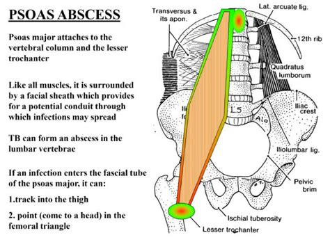 Iliopsoas Muscle Anatomy Function Supply Innervation