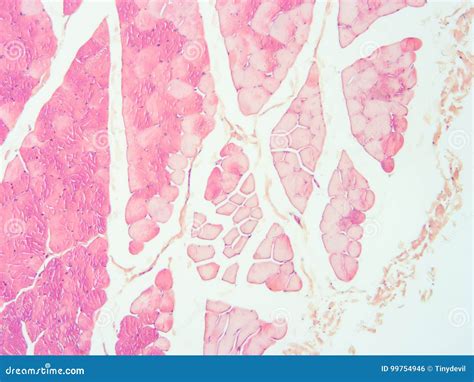 Histologia Do Tecido Humano Da Conex O Do Tend O Do M Sculo Foto De