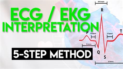 Ecg Interpretation Made Easy Ecg Ekg Interpretation Part 2 Youtube