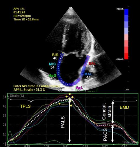 Strain Parameters Measured In Apical Chamber View Pals Peak Atrial