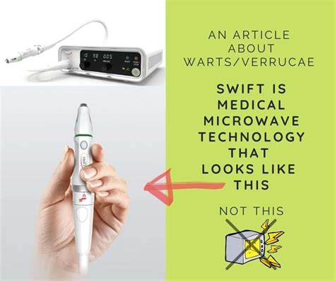 Swift Microwave Your Warts Away New Step Podiatry