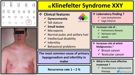 Xxyy Syndrome