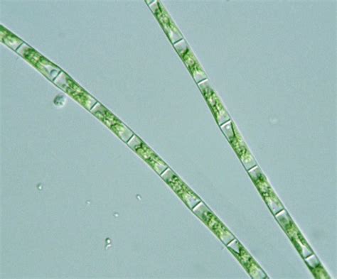 Protist Images Filamentous Algae