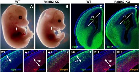 File Mouse Embryo Cortex Radial Expansion Embryology