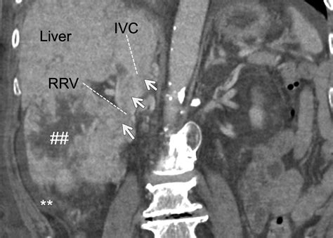 Articles • Applied Radiology